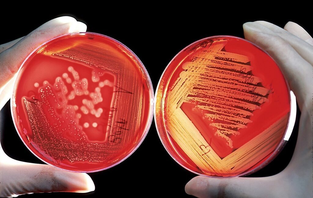 agar-gc0956b716_1280