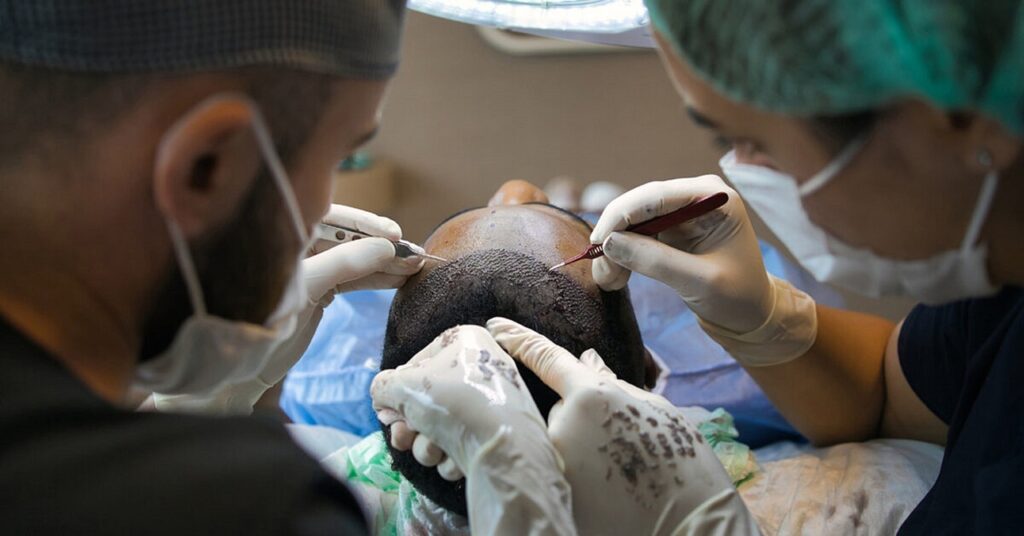 hair-transplant-g249aeb773_1280