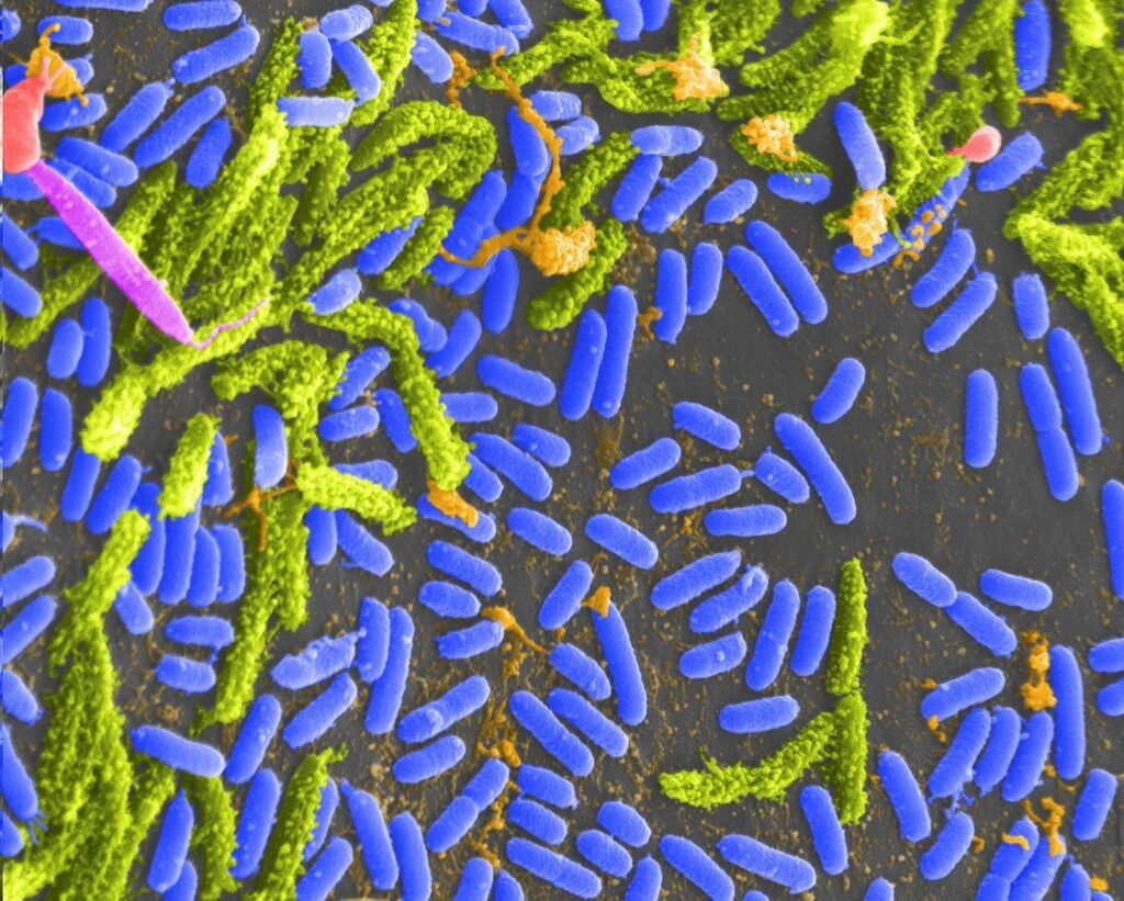 Bacteria