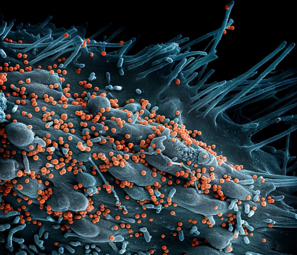 virus